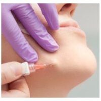 Dermal Dolgular