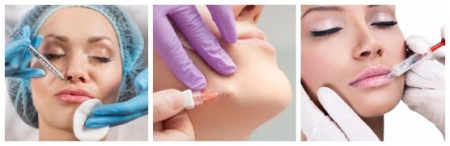 Dermal Dolgular